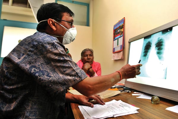 Nepal TB cases grossly underestimated
